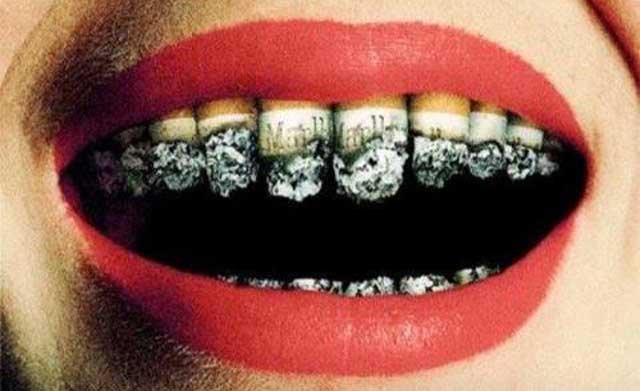 Egy dohányzó ember szája és fogai